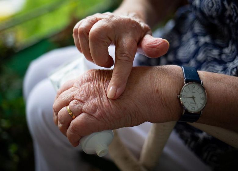 arthritis