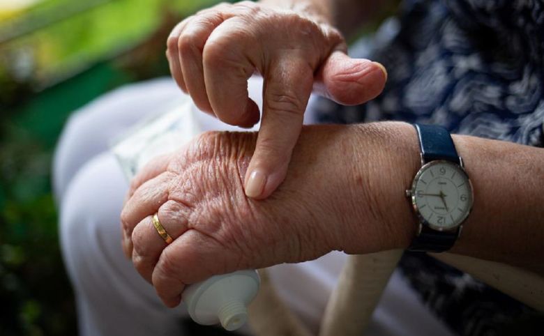 arthritis